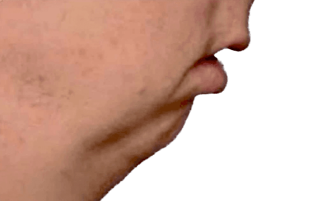 No Chin Churdle!